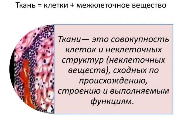 Kraken 14 at